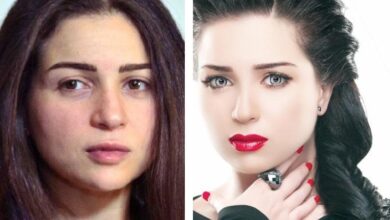 صورة النجمة مي عز الدين تدخل العناية المركزة إثر تعرضها لأزمة صحية طارئة